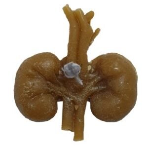 VELA RIÑONES Mini, para sanar o castigar